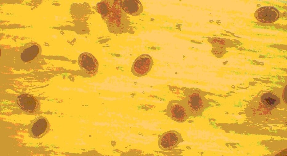 яйца на червеи под микроскоп