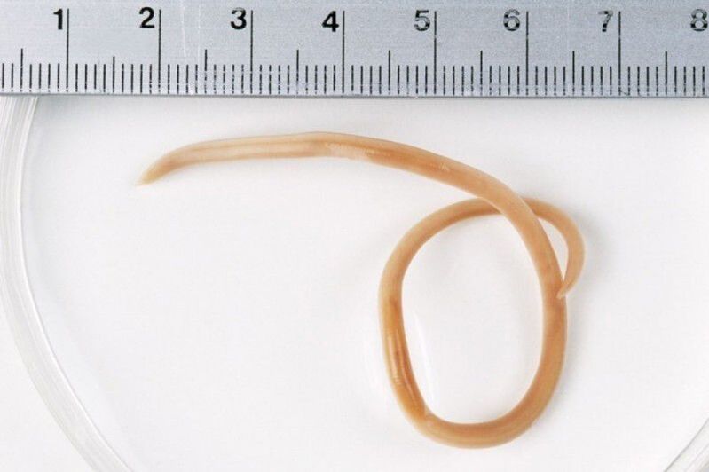 размера на червеите в тялото