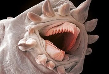 какви червеи могат да живеят в човешкото тяло