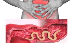 симптоми на наличие на паразити в червата на човека